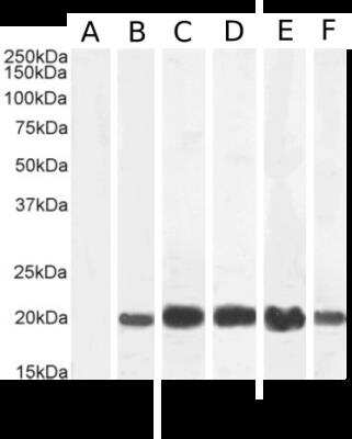 Western Blot: IL-2 Antibody (LNKB-2) [NBP2-81047] - Western Blot using anti-IL-2 antibody (LNKB-2) [NBP2-81047]. Untreated human peripheral blood monocyte (PBM) (A), PMA/lonomycin-treated PBM (B), human spleen (C), human thymus (D), Jurkat cell (E) and Molt4 cell (F) lysate samples (35ug protein in RIPA buffer) were resolved on a 15% SDS PAGE gel and blots probed with the rabbit IgG-chimeric version of LNKB-2 [NBP2-81047] at 1 ug/ml (A, B) or 0.1 ug/ml (C-F) before detection using an anti-rabbit secondary antibody. Protein was detected by chemiluminescence. The expected running size for IL-2 is 17.6kDa. NBP2-81047 successfully detected Il-2 in multiple human tissue / cell samples.