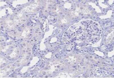 Immunohistochemistry-Paraffin: IL-2 R beta Antibody [NBP2-34148] - Staining of human kidney shows no postivity in cells in tubules as expected.