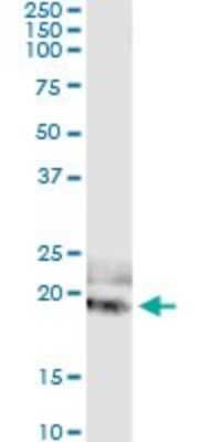 Immunoprecipitation: IL-20 Antibody (2H8) [H00050604-M01] - Analysis of IL20 transfected lysate using anti-IL20 monoclonal antibody and Protein A Magnetic Bead, and immunoblotted with IL20 MaxPab rabbit polyclonal antibody.