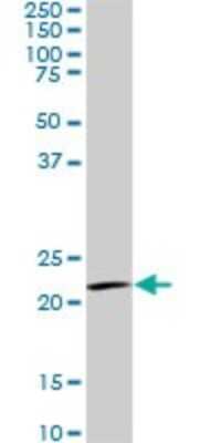Western Blot: IL-20 Antibody (2H8) [H00050604-M01] - IL20 monoclonal antibody (M01), clone 2H8. Analysis of IL20 expression in A-431.