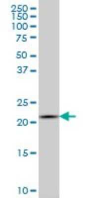 Western Blot: IL-20 Antibody (2H8) [H00050604-M01] - IL20 monoclonal antibody (M01), clone 2H8 Analysis of IL20 expression in K-562.