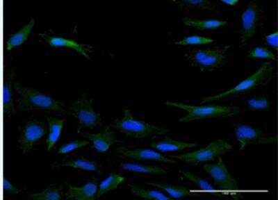 Immunocytochemistry/Immunofluorescence: IL-20 R beta/FNDC6 Antibody [H00053833-B02P-50ug] -  HeLa cell. [antibody concentration 10 ug/ml]
