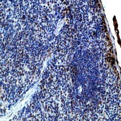 Immunohistochemistry: IL-21 Antibody [NB100-736] - Goat antibody N-terminus of mouse IL-21.