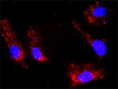 Proximity Ligation Assay: IL-21 Antibody [H00059067-D01P] - Analysis of protein-protein interactions between IL21 and DGKA. HeLa cells were stained with anti-IL21 rabbit purified polyclonal 1:1200 and anti-DGKA mouse monoclonal antibody 1:50. Each red dot represents the detection of protein-protein interaction complex, and nuclei were counterstained with DAPI (blue).