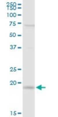 Western Blot: IL-21 Antibody [H00059067-D01P] - Analysis of IL21 expression in A-431.