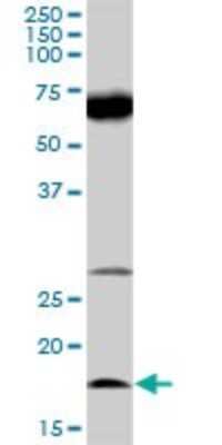 Western Blot: IL-21 Antibody [H00059067-D01P] - Analysis of IL21 expression in human liver.