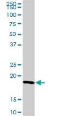 Western Blot: IL-21 Antibody [H00059067-D01P] - Analysis of IL21 expression in mouse kidney.