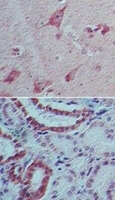 Immunohistochemistry: IL-22 Antibody (8F11E2) - Azide and BSA Free [NBP2-80805] - Analysis of IL-22 in human brain (top) and kidney tissue (bottom) using IL-22 antibody at 5 ug/mL. Image from the standard format of this antibody.