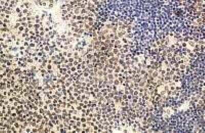 Immunohistochemistry-Paraffin: IL-22 Antibody [NB100-738] - Goat anti-IL-22 antibody on paraffin section of human tonsil.