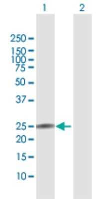 Western Blot: IL-22 Antibody [H00050616-D01P] - Analysis of IL22 expression in transfected 293T cell line by IL22 polyclonal antibody.Lane 1: IL22 transfected lysate(20.00 KDa).Lane 2: Non-transfected lysate.