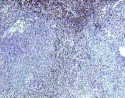 Immunohistochemistry: IL-22 R alpha 1 Antibody [NB100-740] -  Immunohistochemistry with CI0152 on paraffin section of human spleen.