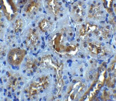 Immunohistochemistry: IL-22R alpha 1 Antibody [NBP1-76724] - Staining of rat kidney tissue with antibody at 5 ug/mL.