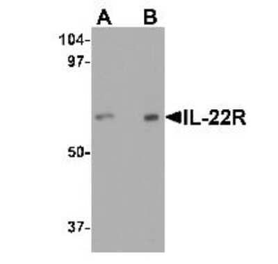 Western Blot: IL-22R alpha 1 Antibody [NBP1-76724] - Analysis of IL-22 receptor expression in human HepG2 cell lysate with IL-22 receptor antibody at (A) 0.5 and (B) 1 ug /ml.