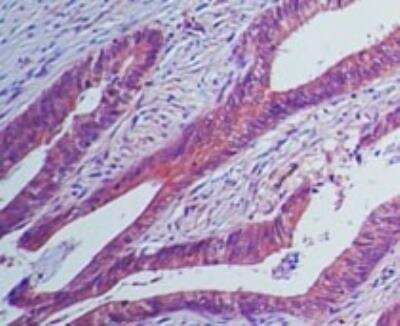 Immunohistochemistry-Paraffin: IL-23 R Antibody (15N6C6) [NBP2-27091] - Analysis of IL-23 receptor in human colon tissue using IL-23 receptor antibody at 5 ug/mL.