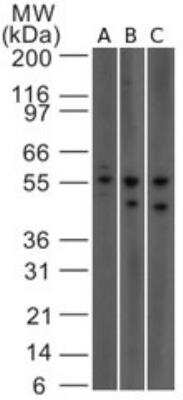 Western Blot: IL-23 R Antibody (15N6C6) [NBP2-27091] - Analysis using IL-23 receptor antibody. Lysate from (A) human HCT116, (B) Jurkat and C) mouse NIH 3T3 cells probed with IL-23 receptor antibody at 1 ug/mL.