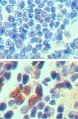 Immunohistochemistry-Paraffin: IL-23 R Antibody [NB600-1147] - Analysis of Mouse spleen tissue probed with isotype control antibody (top) and IL-23R antibody (bottom) at 5 ug/ml.