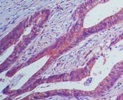 Immunohistochemistry-Paraffin: IL-23R Antibody (15N6C6) - Azide Free [NBP2-27092] - Analysis of IL-23 receptor in human colon tissue using IL-23 receptor antibody at 5 ug/ml.