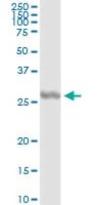 Immunoprecipitation: IL-27 Antibody (3F12) [H00246778-M01] - Analysis of IL27 transfected lysate using anti-IL27 monoclonal antibody and Protein A Magnetic Bead, and immunoblotted with IL27 MaxPab rabbit polyclonal antibody.
