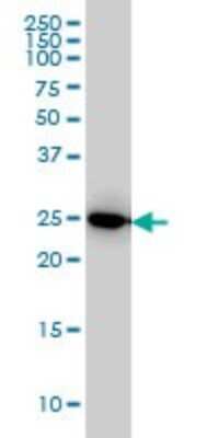 Western Blot: IL-27 Antibody (3F12) [H00246778-M01] - IL27 monoclonal antibody (M01), clone 3F12 Analysis of IL27 expression in HeLa.
