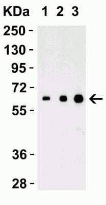 Western Blot: IL-27 Antibody [NBP1-76698] - Recombinant Protein Validation. Loading: 30 ng of human recombinant IL-17(IL-17A+IL-17B) protein per lane. Antibodies: IL-27 NBP1-76698, 1h incubation at RT in 5% NFDM/TBST. Secondary: Goat anti-rabbit IgG HRP conjugate at 1:10000 dilution. Lane 1: 0.5 ug/mL, Lane 2: 1 ug/mL, Lane 3: 2 ug/mL.