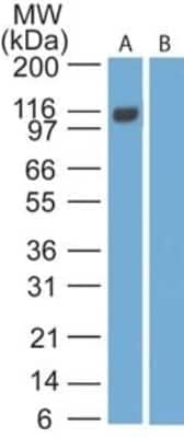 Western Blot: IL-27/IL-35 EBI3 Subunit Antibody (15k8D10) - Azide Free [NBP2-27363] - analysis of Interleukin-35-Fc protein (A) and human Fc (B) using Interleukin-35 monoclonal antibody at 4 ug/ml.