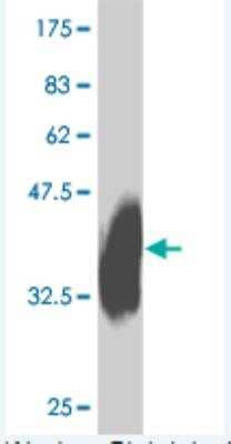 Western Blot: IL-27 R alpha/WSX-1/TCCR Antibody (8G9) [H00009466-M01] -  Detection against Immunogen (36.74 KDa) .