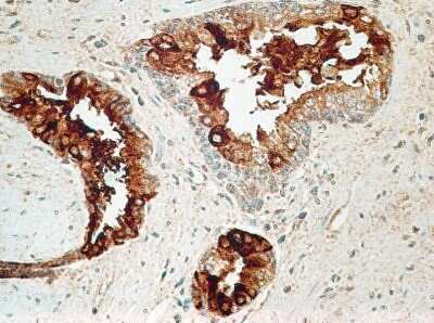 Immunohistochemistry: IL-27R alpha/WSX-1/TCCR Antibody (34N4G11) - Azide and BSA Free [NBP2-80807] - FFPE human prostate probed with IL-27R antibody at 5 ug/ml. Image from the standard format of this antibody.