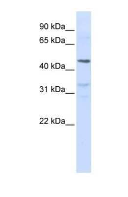 Western Blot: IL-28 R alpha/IFN-lambda R1 Antibody [NBP1-69635] - This Anti-IL28RA antibody was used in Western Blot of Jurkat tissue lysate at a concentration of 1ug/ml.
