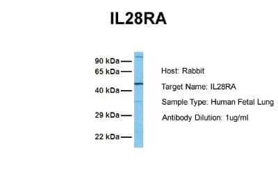 Western Blot: IL-28 R alpha/IFN-lambda R1 Antibody [NBP1-69635] - Sample Tissue: Human Fetal Lung Antibody Dilution: 1.0 ug/ml