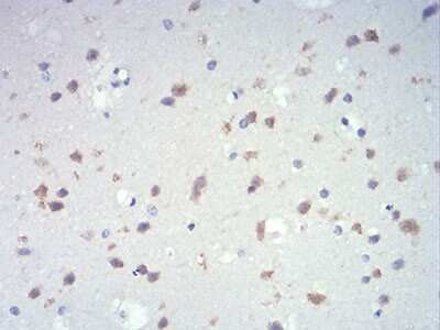 Immunohistochemistry: IL-28A/IFN-lambda 2 Antibody (7B9A4) [NBP2-52494] - Analysis of paraffin-embedded brain tissues using IL28A mouse mAb with DAB staining.