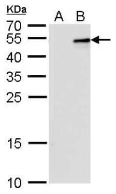 Western Blot: IL-28B/IFN-lambda 3 Antibody (2512) [NBP2-43739] - Analysis of A. 30 ug 293T whole cell lysate/extract B. 30 ug whole cell lysate/extract of GFP-human IL28B-transfected 293T cells 12 % SDS-PAGE IL28B antibody [2512] dilution: 1:5000.