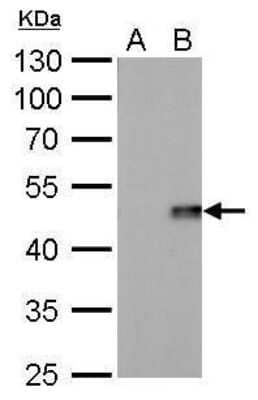 Western Blot: IL-28B/IFN-lambda 3 Antibody (617) [NBP2-43738] - Analysis of A. 30 ug 293T whole cell lysate/extract B. 30 ug whole cell lysate/extract of GFP-human IL28-transfected 293T cells 10 % SDS-PAGE IL28B antibody [617] dilution: 1:5000.