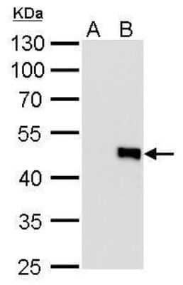 Western Blot: IL-28B/IFN-lambda 3 Antibody (727) [NBP2-43737] - Analysis of A. 30 ug 293T whole cell lysate/extract B. 30 ug whole cell lysate/extract of GFP-human IL28-transfected 293T cells 10 % SDS-PAGE IL28B antibody [727] dilution: 1:5000.