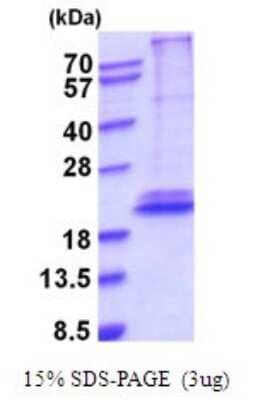 SDS-Page: Recombinant Human IL-28B/IFN-lambda 3 Protein [NBP2-52083] -  15% SDS Page (3 ug)