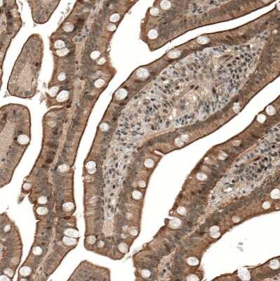 Immunohistochemistry-Paraffin: IL-28R alpha/IFN-lambda R1 Antibody [NBP1-84381] - Staining of human duodenum shows membranous/cytoplasmic positivity in glandular cells.