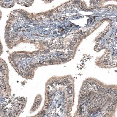 Immunohistochemistry-Paraffin: IL-28R alpha/IFN-lambda R1 Antibody [NBP1-84381] - Staining of human fallopian tube shows moderate  membranous/cytoplasmic positivity in glandular cells.