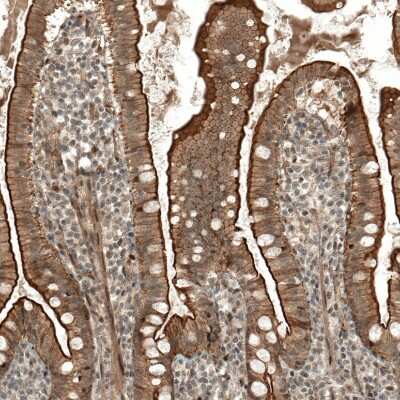 Immunohistochemistry-Paraffin IL-28R alpha/IFN-lambda R1 Antibody - BSA Free