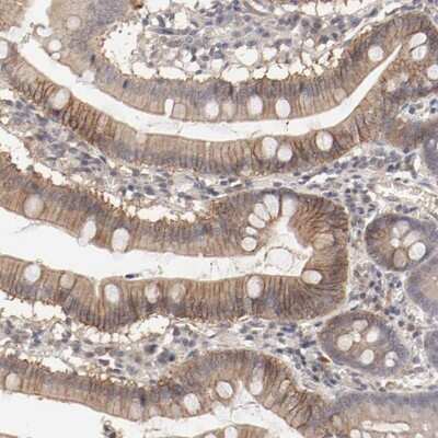 Immunohistochemistry-Paraffin: IL-3 R alpha/CD123 Antibody [NBP1-86549] - Staining of human small intestine shows cytoplasmic and membranous positivity in glandular cells.