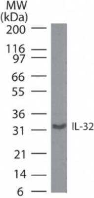 Western Blot: IL-32 Antibody [NBP2-24728] -  Analysis of IL-32 in human lymph node lysate. Lane 1 shows pre-immune sera. Lane 2 shows human lymph node lysate using NBP2-24728 at 5 ug/ml.