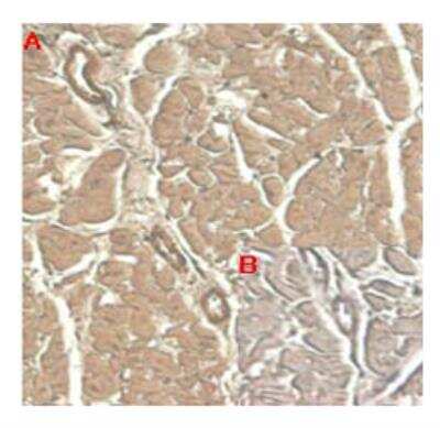 Immunohistochemistry: IL-33 Antibody (IL33305B) [NBP3-11681] - Immunohistochemical staining of human tissue using  IL-33 antibody (IL33305B) at 1:100 dilution.A. Immunoperoxidase staining (cytoplasmic) of formalin-fixed, paraffin-embedded human heart (100x, brown colour).B. Isotype control with IgG2a (negative control).