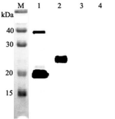 Western Blot: IL-33 Antibody (IL33305B) [NBP3-11681] - Western blot analysis of human IL-33 using IL-33 antibody (IL33305B) at 1:2,000 dilution.1. Recombinant human IL-33 (His tagged).2. Recombinant human IL-33 (FLAG(R)-tagged).3. Recombinant mouse IL-33 (FLAG(R)-tagged).4. Other protein (His tagged, negative control).