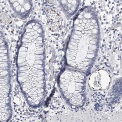 Immunohistochemistry-Paraffin: IL-33 Antibody [NBP1-86702] - Staining of human colon shows nuclear positivity in endothelial cells.