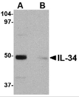 Western Blot: IL-34 Antibody [NBP1-76356] - Analysis of IL-34 in human brain tissue lysate with IL-34 antibody at 0.25 ug/mL in (A) the absence and (B) the presence of blocking peptide.