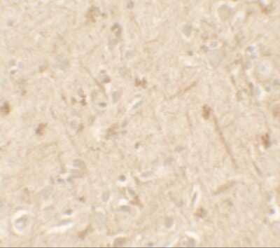 Immunohistochemistry: IL-36 alpha/IL-1F6 Antibody [NBP2-41238] - Immunohistochemistry of IL-36A in human brain tissue with IL-36A antibody at 5 ug/mL.