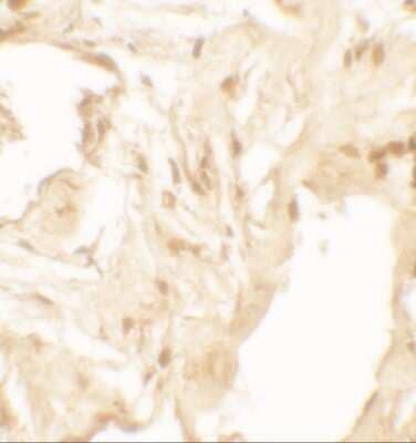 Immunohistochemistry: IL-36 beta/IL-1F8 Antibody [NBP2-41239] - Immunohistochemistry of IL-36B in human lung tissue with IL-36B antibody at 2.5 ug/mL.