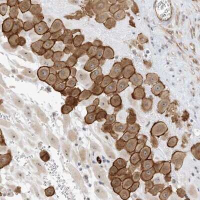 Immunohistochemistry-Paraffin: IL-36 beta/IL-1F8 Antibody [NBP1-83892] - Staining of human placenta shows distinct membranous and cytoplasmic positivity in decidua cells.