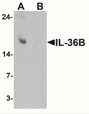 Western Blot: IL-36 beta/IL-1F8 Antibody [NBP2-41239] - Western blot analysis of IL-36B in A549 cell lysate with IL-36B antibody at 1 ug/ml in (A) the absence and (B) the presence of blocking peptide.