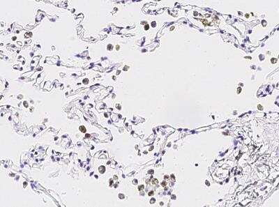 Immunohistochemistry-Paraffin: IL-36 gamma/IL-1F9 Antibody (013) [NBP2-89281] - Staining of human IL1F9 in human lung with rabbit monoclonal antibody (1:20000).