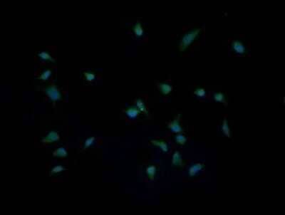 Immunocytochemistry/Immunofluorescence: IL-36 gamma/IL-1F9 Antibody (OTI2F4) - Azide and BSA Free [NBP2-72055] - Analysis of HeLa cells.