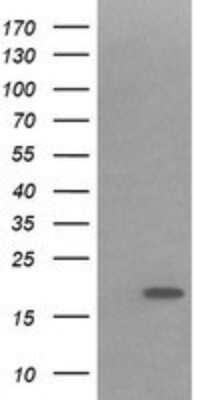 Western Blot: IL-36 gamma/IL-1F9 Antibody (OTI2F4) - Azide and BSA Free [NBP2-72055] - Analysis of HEK293T cells were transfected with the pCMV6-ENTRY control (Left lane) or pCMV6-ENTRY IL1F9.